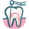 Root Canal Treatment